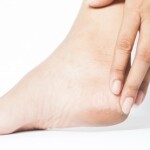 A person who needs heel treatment